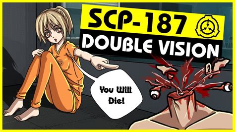SCP 187