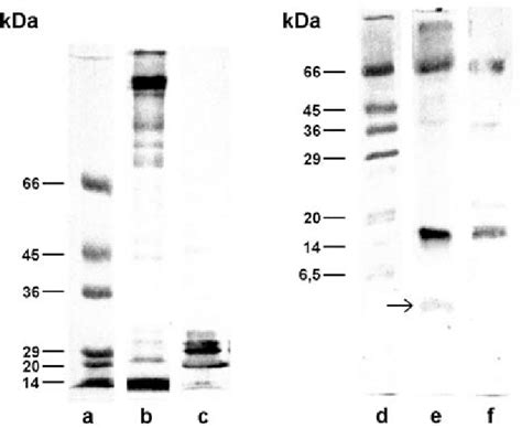 SDS/PAGE of crude extracts of bovine erythrocyte