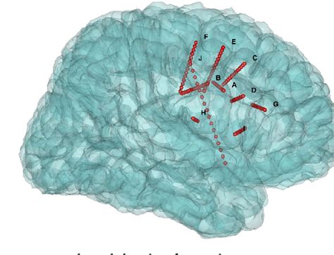 SEEG-Net: An explainable and deep learning-based cross …