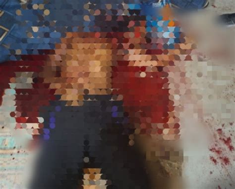 Semprot Parfum di Leher Disebut Picu Gangguan Tiroid ... - detikHealth - muktibox.com