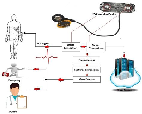 Sensor analytics for interpretation of EKG signals - coolestguyplanet.net