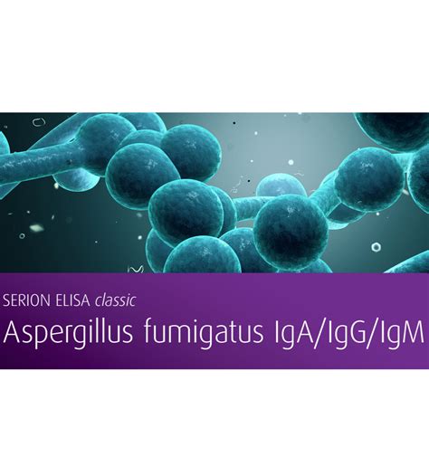 Seroprevalensi IgG spesifik A. fumigatus dan identifikasi Aspergillus ... - wintechmobiles.com