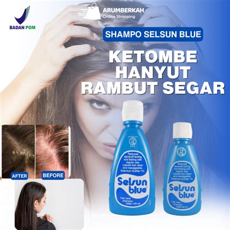 Shampoo Anti Ketombe Dan Rontok - balustradellc