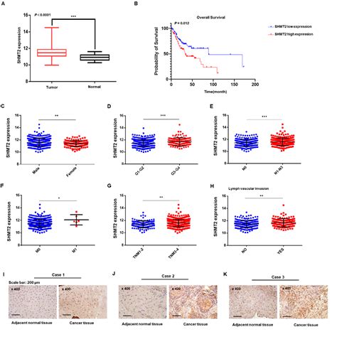 SHMT2 Induces Stemness and Progression of Head and Neck Cancer