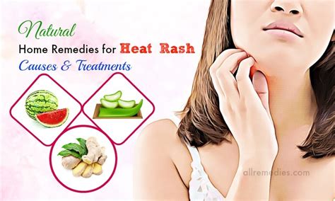 Simple Home Remedies for Heat Rash Relief - Verywell … - balustradellc