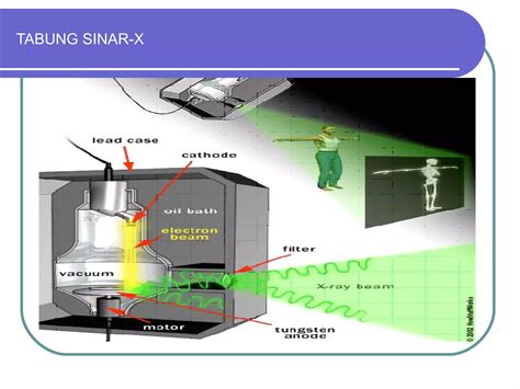 Sinar-X - Wikipedia bahasa Indonesia, ensiklopedia bebas - wintechmobiles.com