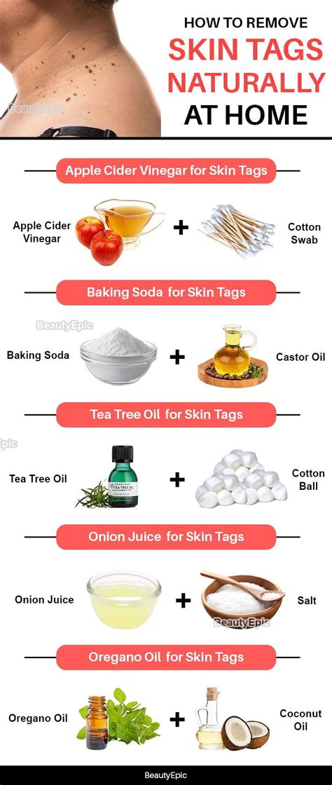 Skin Tag Removal: Home Remedies That Work - Greatist - balustradellc