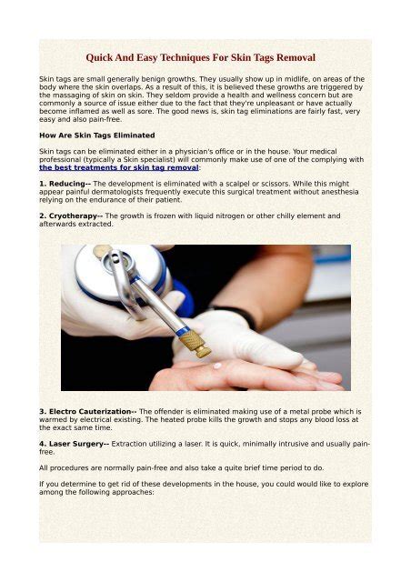 Skin Tags Removal: Dermatologist-Approved Techniques - balustradellc