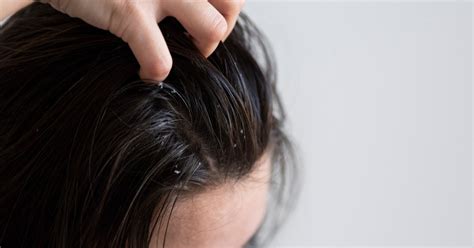 Solusi Praktis untuk Rambut Berminyak dan Lepek - balustradellc