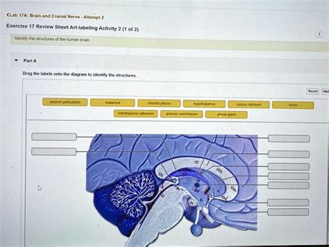 SOLVED Text Identify the structures of the human brain. Lab 17A