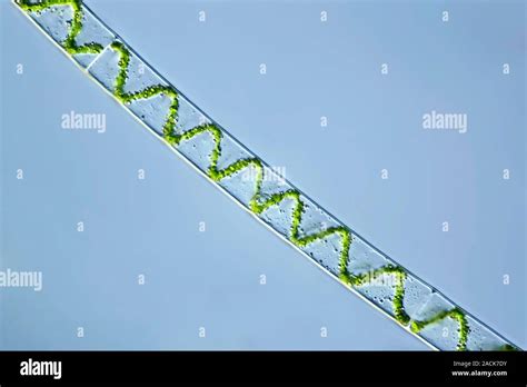 Spirogyra Sp - muktibox.com