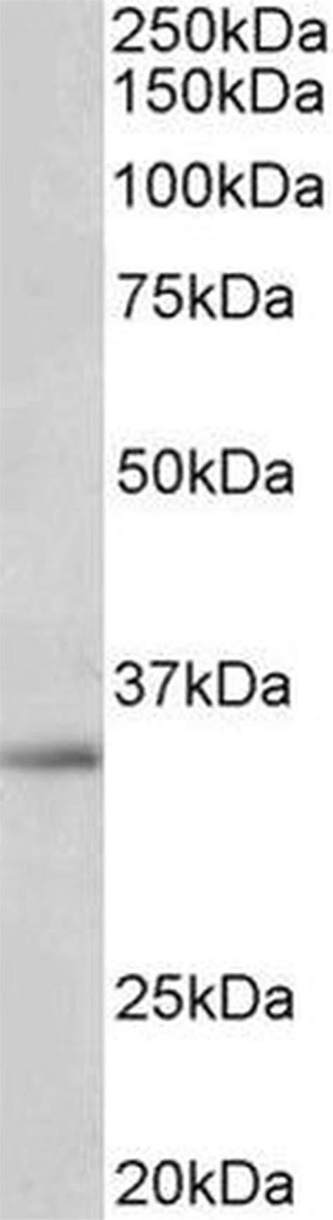 SPON2 Polyclonal Antibody (PA5-37919) - Thermo Fisher