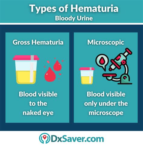 STD That Causes Blood In The Urine: Causes, Treatment & Testing …