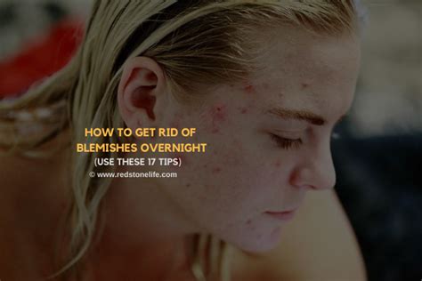 Steps to Get Rid of Blemishes Overnight - FOREO - balustradellc