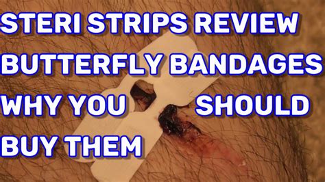 Steri Strips Butterfly bandages How to Use Them for Cut Wounds … - balustradellc