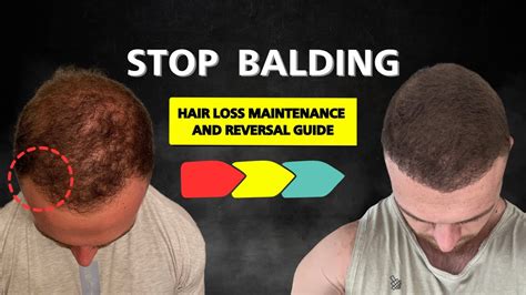 STOP balding with these 3 products - balustradellc