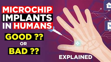 STOP HUMAN IMPLANTATION OF RFID MICROCHIP