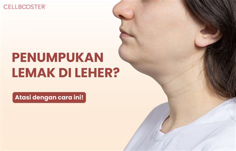 Strategi Efektif Mengatasi Lemak di Leher, Berikut Tips … - balustradellc