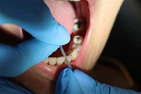 Stripping & Deoxidation | Inventec Performance Chemicals - muktibox.com