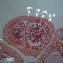 Stuktur Anatomis dan Profil Histokimia Strobilus Jantan Melinjo (Gnetum ... - raincitystudios.com