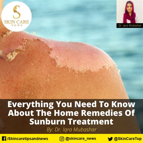 Sunburn Treatment & Home Remedies: How To Relieve Sunburn … - balustradellc