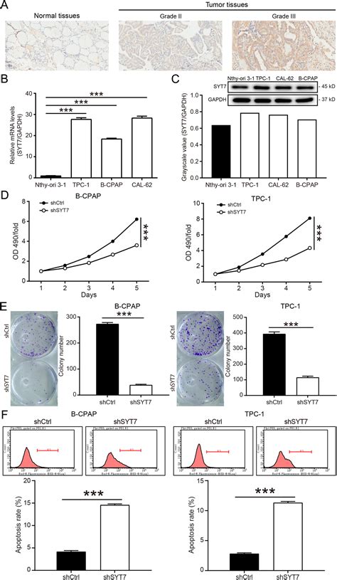 SYT7 plays a role in promoting thyroid cancer by mediating …