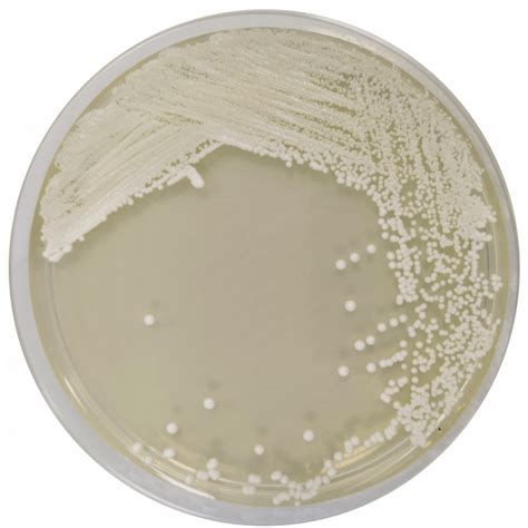 Sabouraud Dextrose Agar with Chloramphenicol