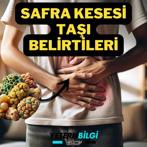 Safra taşı Vikipedi.