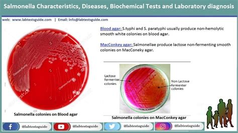 Salmonella Lab Tests Guide