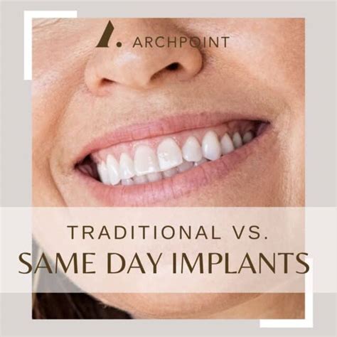 Same Day Dental Implants & Teeth Key Hole Implants Best …