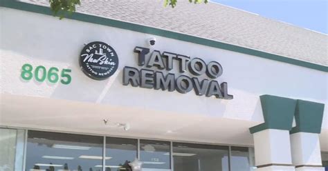 San Jose low-cost tattoo removal nonprofit opens Sacramento shop
