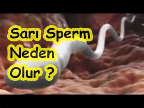 Sarı renk sperm
