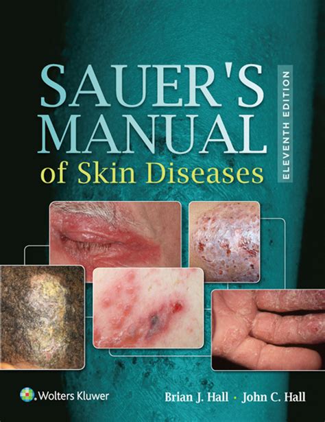 Sauers manual of skin diseases manual of skin diseases sauer. - Weltanschauung der deutschen aufklärung in geschichtlicher entwicklung..