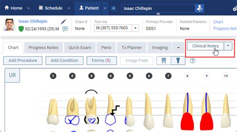 Save Time with Clinical Note Templates Dentrix Ascend