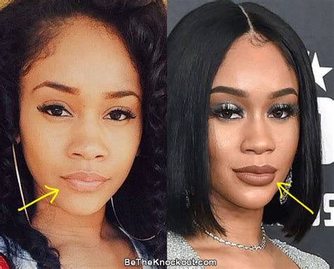 Saweetie before and after. Saweetie. Saweetie is an American rapper and songwriter best known for her song ‘Icy Grl.’. She is from Hayward, California, and currently lives in Los Angeles, California. Her mother is Filipino, and her father is African–American. In her teenage years, she developed a keen interest in music. She started writing music at the age of 14. 