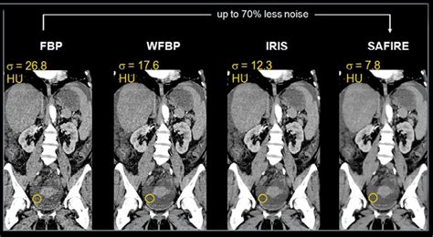 Sc@Rlettxs@V@Ge Onlyfans Leaked [HD] 🍆 240 Photos