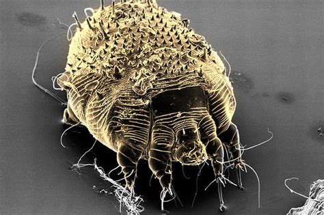 Scabies What you need to know about it AIRCLINIC