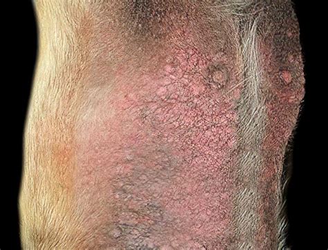 Scabies in Dogs, Scabies Rash Picture, Pictures of Scabies