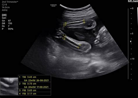 Scan 4D Ibu Hamil: Top 5 Essential Cinema 4D Tips for Beginners You Need to Know image 1