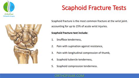Scaphoid Fracture Test & Example Free PDF Download