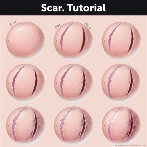 Scar. Tutorial by Anastasiaberry on DeviantArt Anatomy Reference