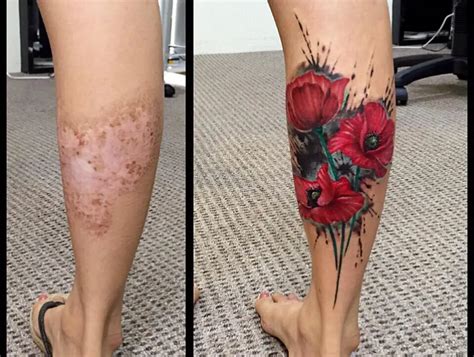 Scarred tattoo. Tattoo scarring is usually caused by one of two things. Good news! Both situations are avoidable. Thoroughly researching your tattoo artist and properly caring … 