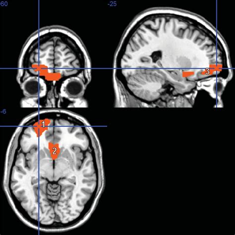 Schizophrenia dataset.  This new encoded dataset of scalogram images can be further...