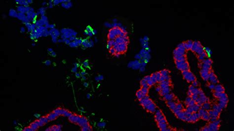 Scientists Develop Model for IBD Fibrosis Using Stem Cells Cedars Sinai