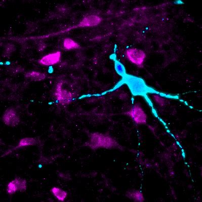Scientists Re Create Brain Neurons to Study Obesity and Personalize Treatment