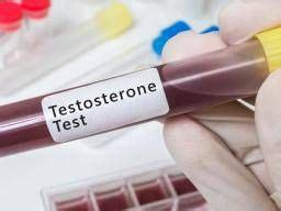 Scientists use stem cells to restore testosterone - Medical News Today