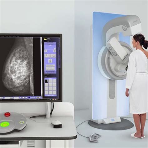 Screening Mammogram 2D and 3D Tomosynthesis Cedars Sinai