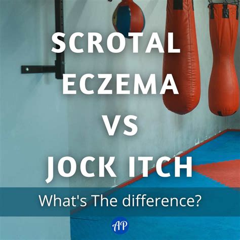 Scrotal eczema vs jock itch. The same rash will likely occur in other areas of the body, as well as on the testicles. The thinner skin of the ball sack makes it feel particularly itchy and uncomfortable. 5. Crabs or pubic ... 