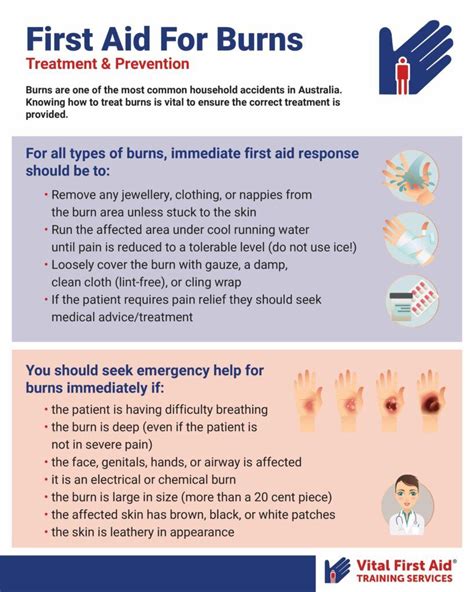 Seal Face Burns: Comprehensive Guide to Prevention and Management