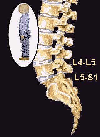 Search Page 1/20: arthropathy of lumbar facet - ICD10Data.com